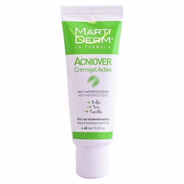 Процедура, устраняющие недостатки кожи Acniover Martiderm 1472-35716 (40 ml) 40 ml (1 штук)